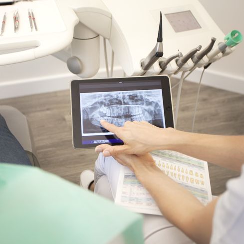 Endodontie bei Zahnarzt Linz bei Remagen